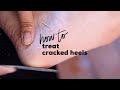 DIY PEDICURE FOR CRACKED HEELS | How to Treat Cracked Heels At Home